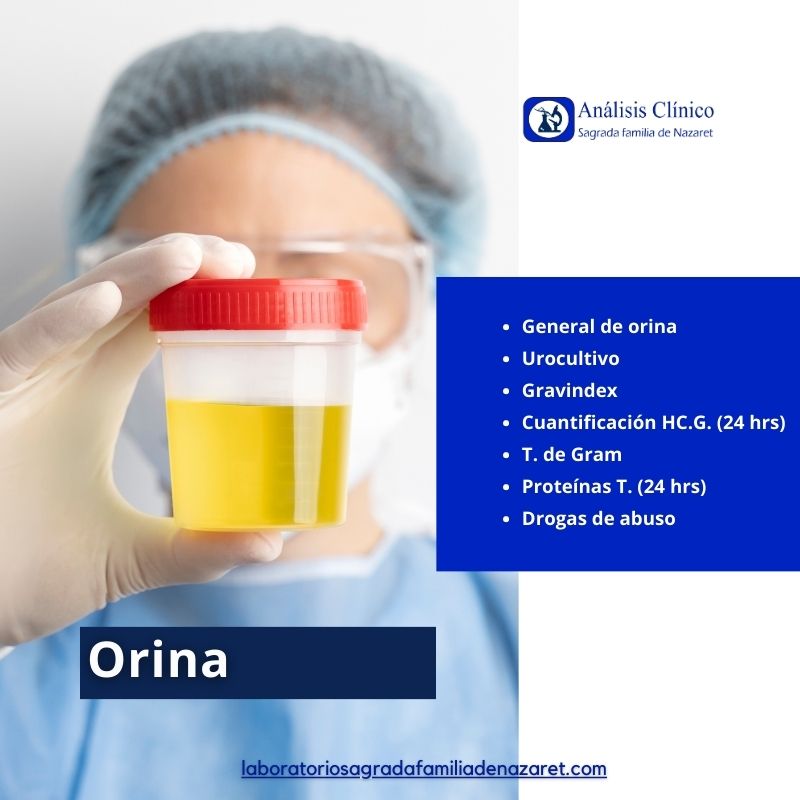 orina